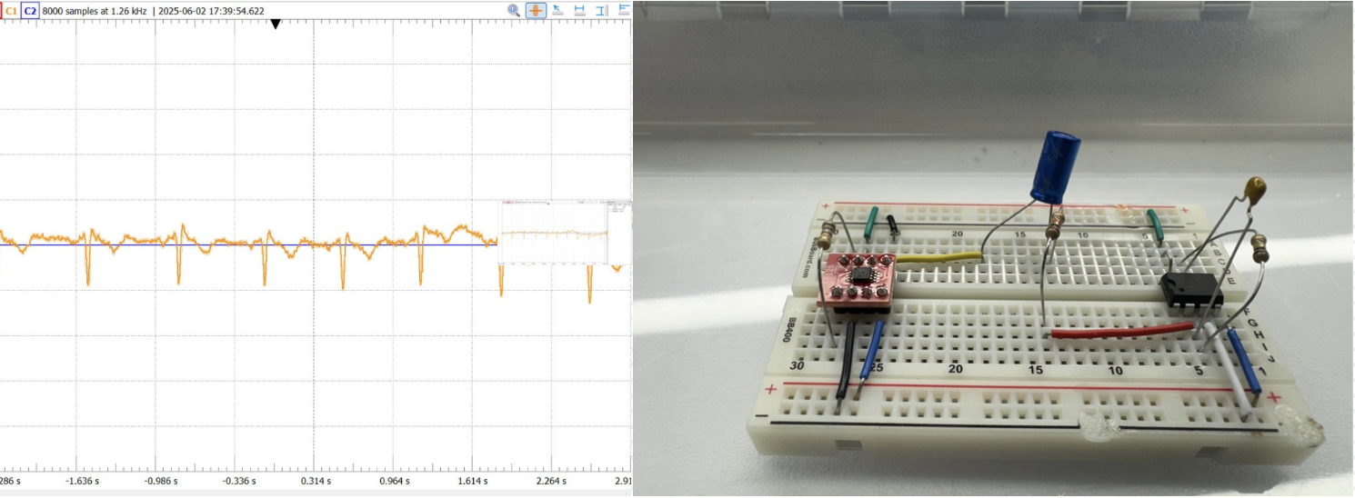 Electro Cardiogram Project