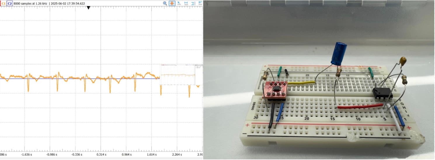 Electro Cardiogram Project