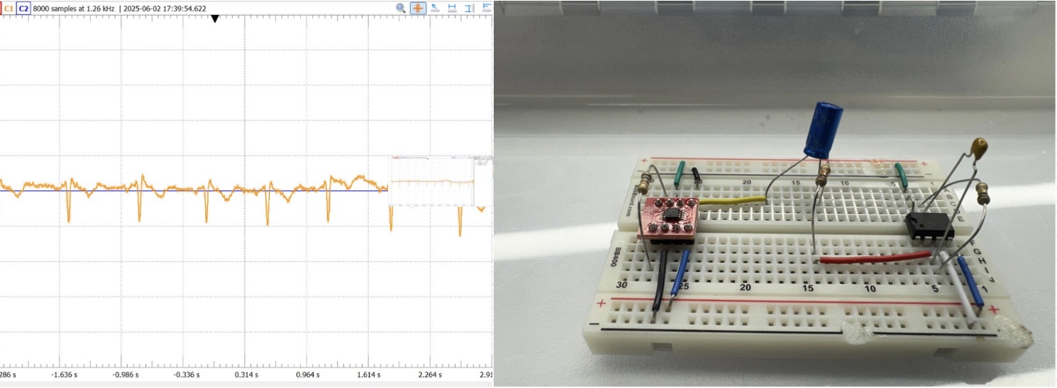Electro Cardiogram Project